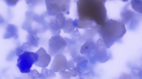A magnified view of lapis lazuli particles embedded in dental plaque.