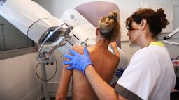 A patient has a mammogram at the Paoli-Calmette Institute in Marseille, France, on October 9, 2017.