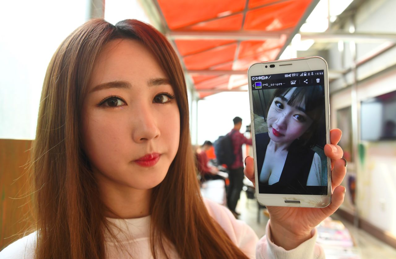 Lee So-Young, a member of K-pop group SixBomb, shows a photo of herself before her plastic surgery at a beauty parlour in Seoul.