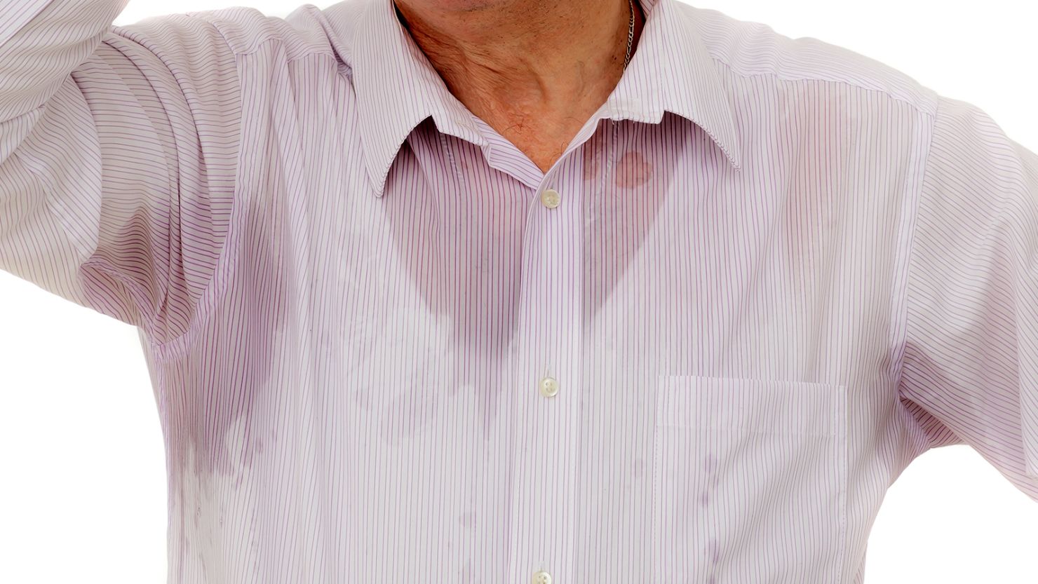 A case reports described a man who struggled with unexplained sweating episodes for years.