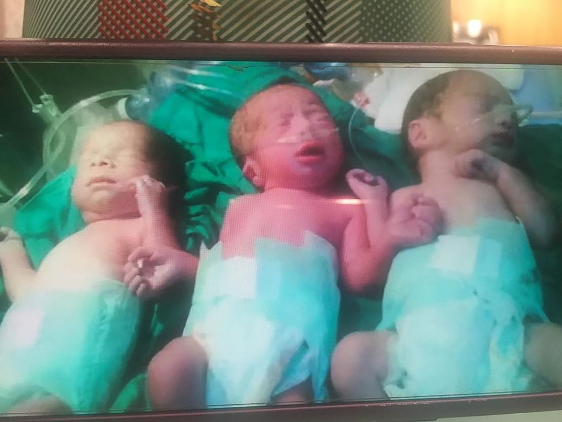One of Tursun's few pictures of her three triplets together before Mohaned died in 2015.