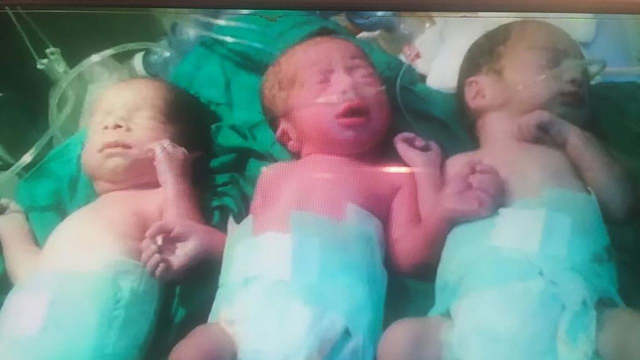 One of Tursun's few pictures of her three triplets together before Mohaned died in 2015.