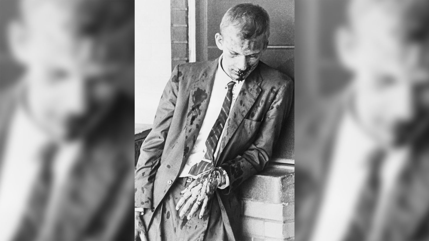 Freedom Rider James Zwerg stands bleeding after an attack by white pro-segregationists in Montgomery, Alabama, in 1961. Zwerg remained in the street for over an hour after the beating, since "white ambulances" refused to treat him.