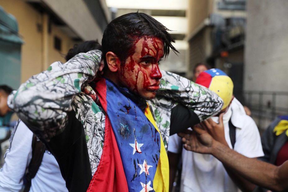 A wounded protester in Caracas on January 23.