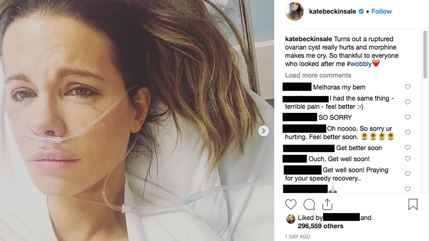 Kate Beckinsale Instagramed about her hospitalization with a ruptured ovarian cyst. "Turns out a ruptured ovarian cyst really hurts and morphine makes me cry. 