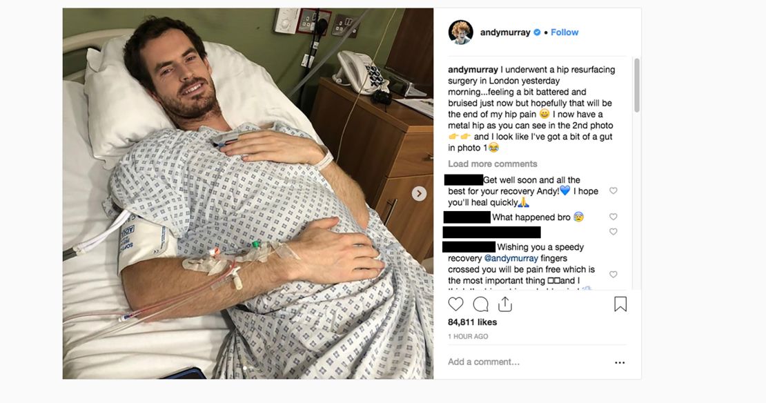 Andy Murray posted an update of his surgery on Instagram.
