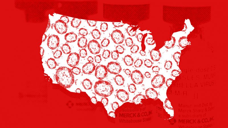 Measles outbreaks challenge public health systems
