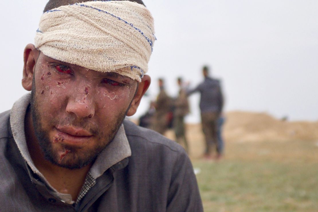 Abdul Rahman was  wounded by an airstrike on his home in Baghouz Al-Fawqani.