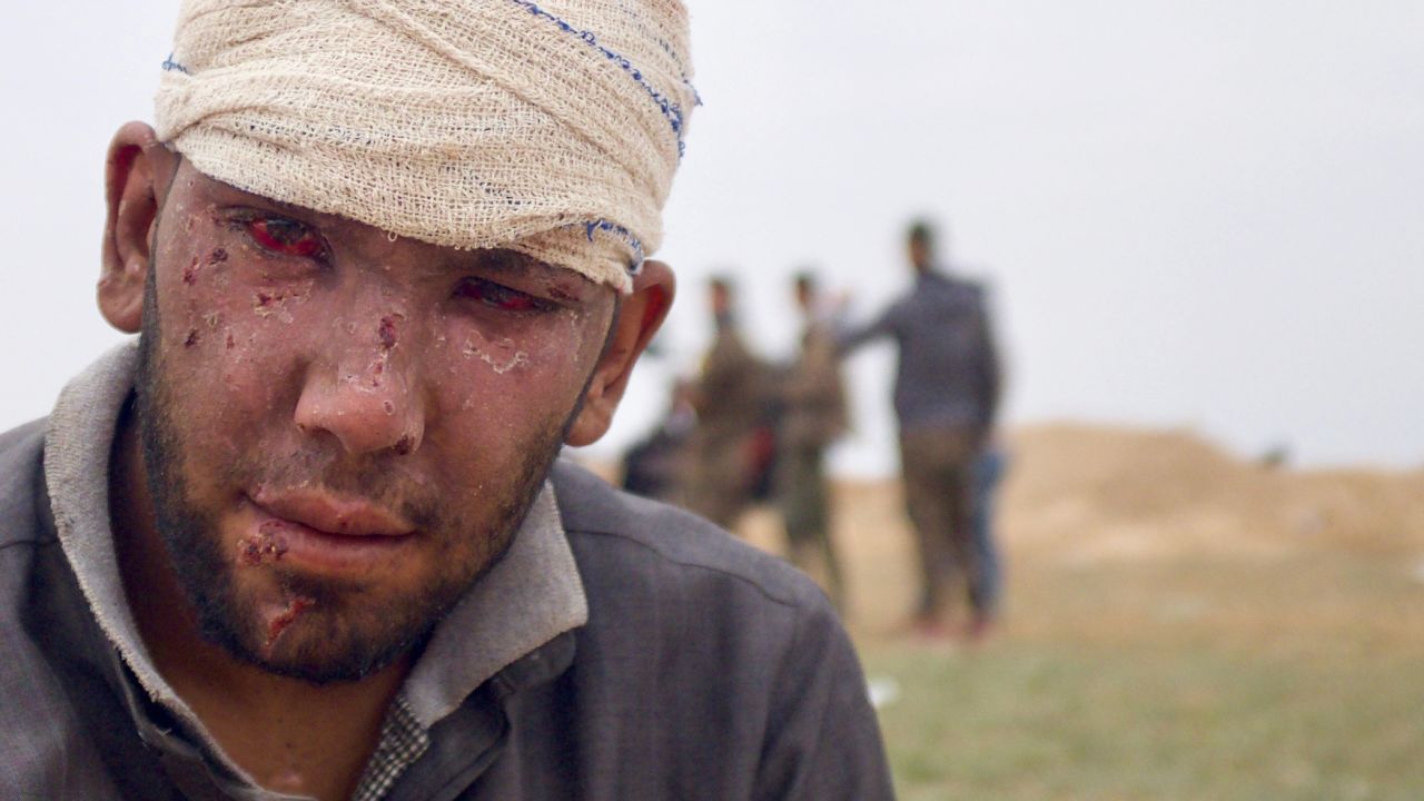 Abdul Rahman was wounded by an airstrike on his home in Baghouz Al-Fawqani.