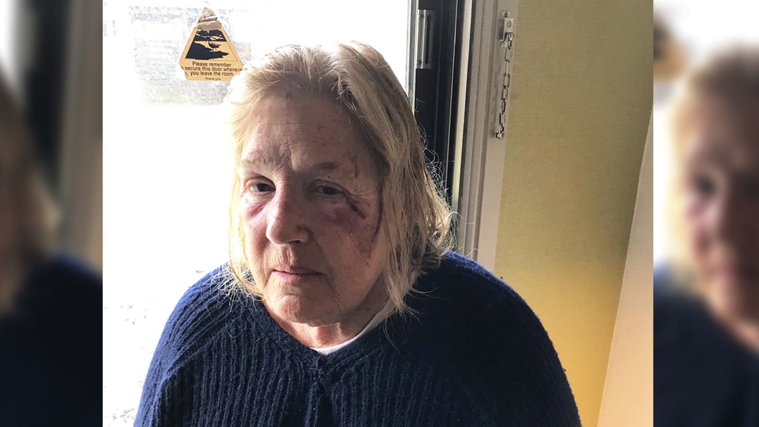 Susan Gordon suffered cuts and bruises when she was trapped in her collapsed home after a mudslide.