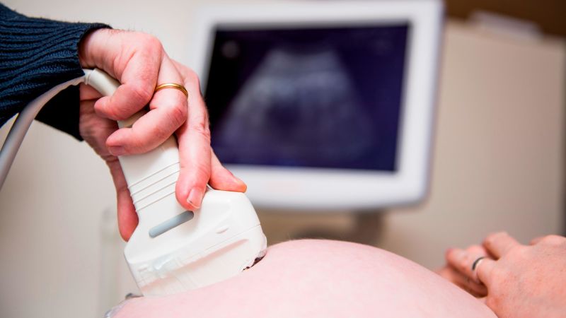 一项研究发现美国早产率呈上升趋势，但原因仍是个谜