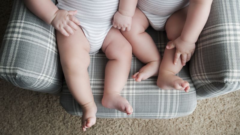 Semi Identical Twins Are Rare And Doctors Say They Ve Identified The Second Case Ever Cnn Semi Identical Twins Are Rare And Doctors Say They Ve Identified The Second Case Ever Cnn