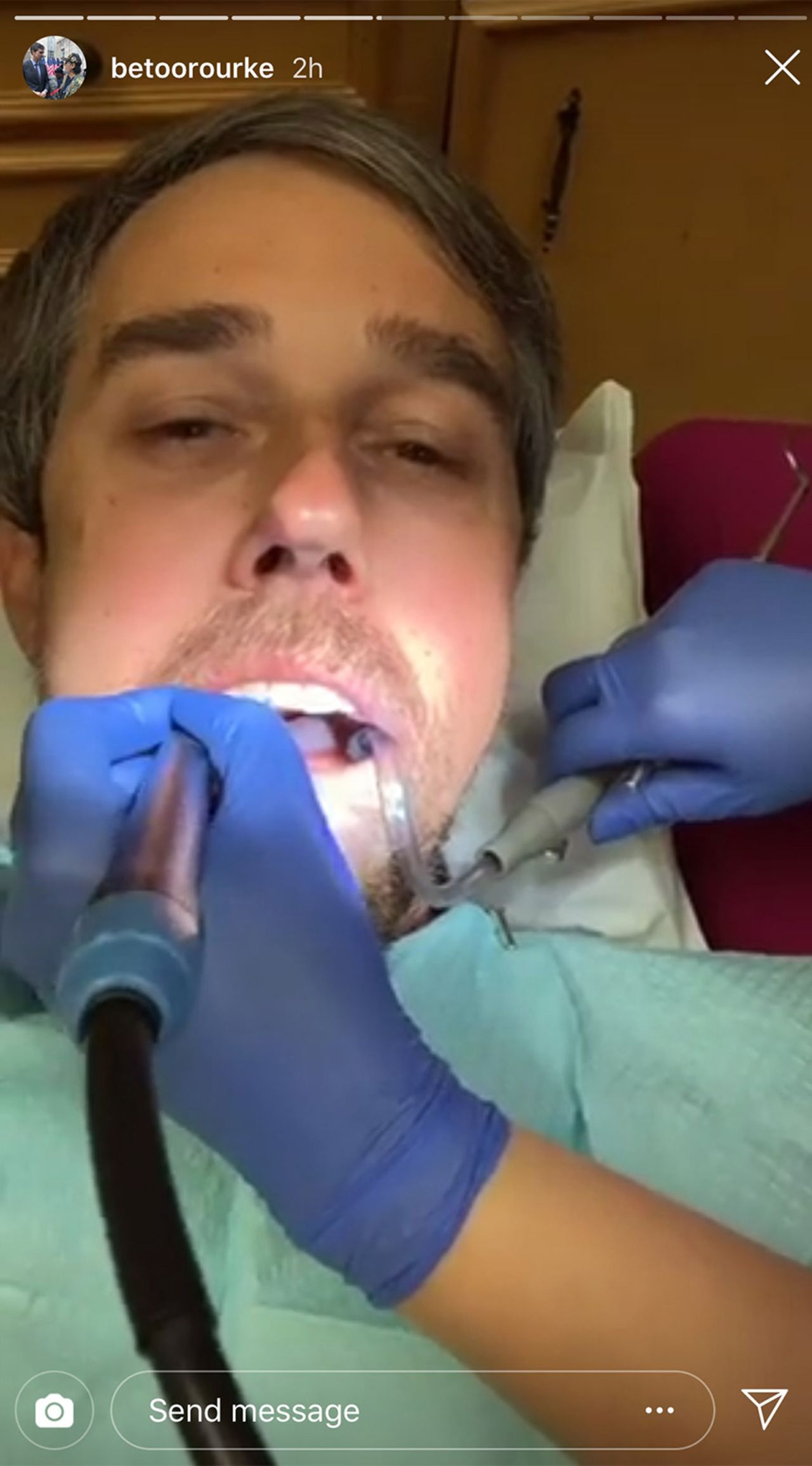 While at the dentist in January 2019, O'Rourke <a href="https://www.cnn.com/2019/01/10/politics/beto-orourke-dentist-instagram/index.html" target="_blank">posted video to Instagram.</a> "We're going to continue our series on the people of the border," he said, introducing his dental hygienist Diana and saying she was "going to tell us a little bit about growing up in El Paso." Diana explained that her mother was from Mexico and her father was from the United States. She said she was born in El Paso and that her neighborhood helped her mother study to become a US citizen.
