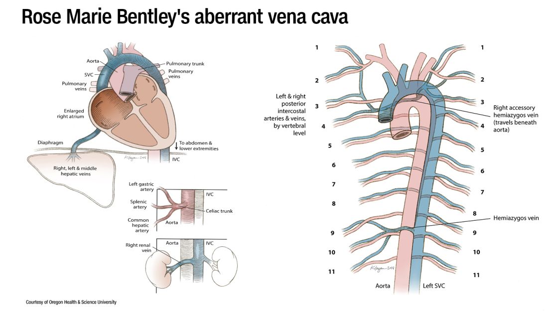 20190408-backwards-organs_vena_cava