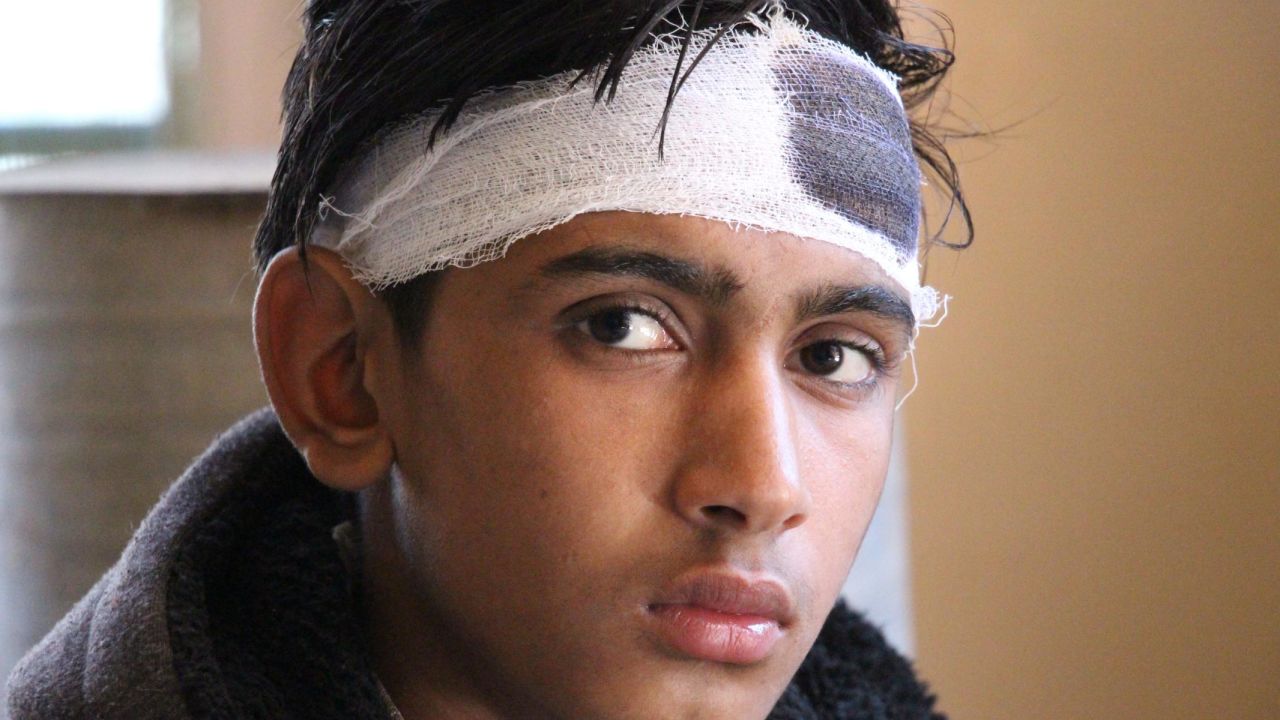 Mohammad Ansar, 16, was knocked unconscious when a shell landed close to where he stood. 
