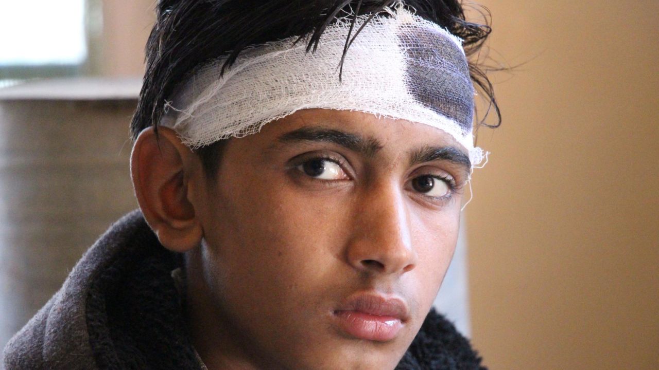 Mohammad Ansar, 16, was knocked unconscious when a shell landed close to where he stood.