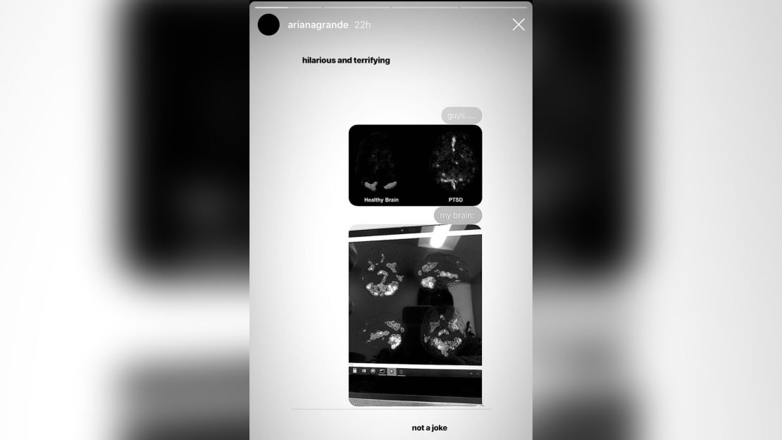 Ariana Grande shares her brain scan on Instagram.