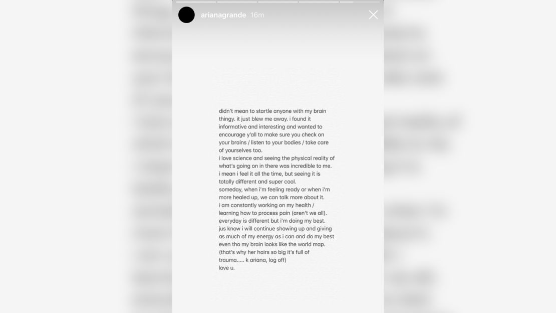 Ariana Grande responds to fans about her brain scan on Instagram.