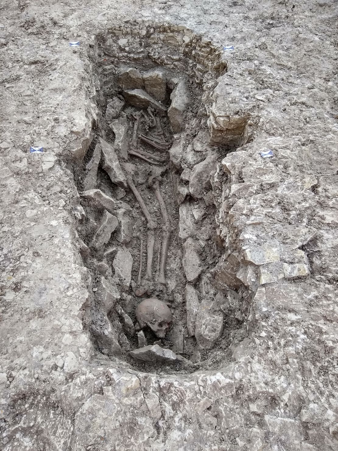 A skeleton found with its skull placed at its feet.