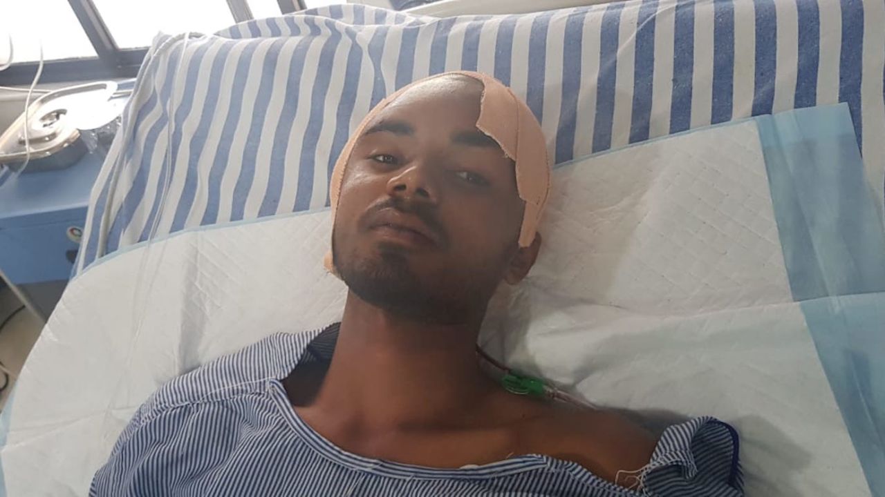 The 21-year-old is expected to make a full recovery after he was impaled through the head with an iron rod.
