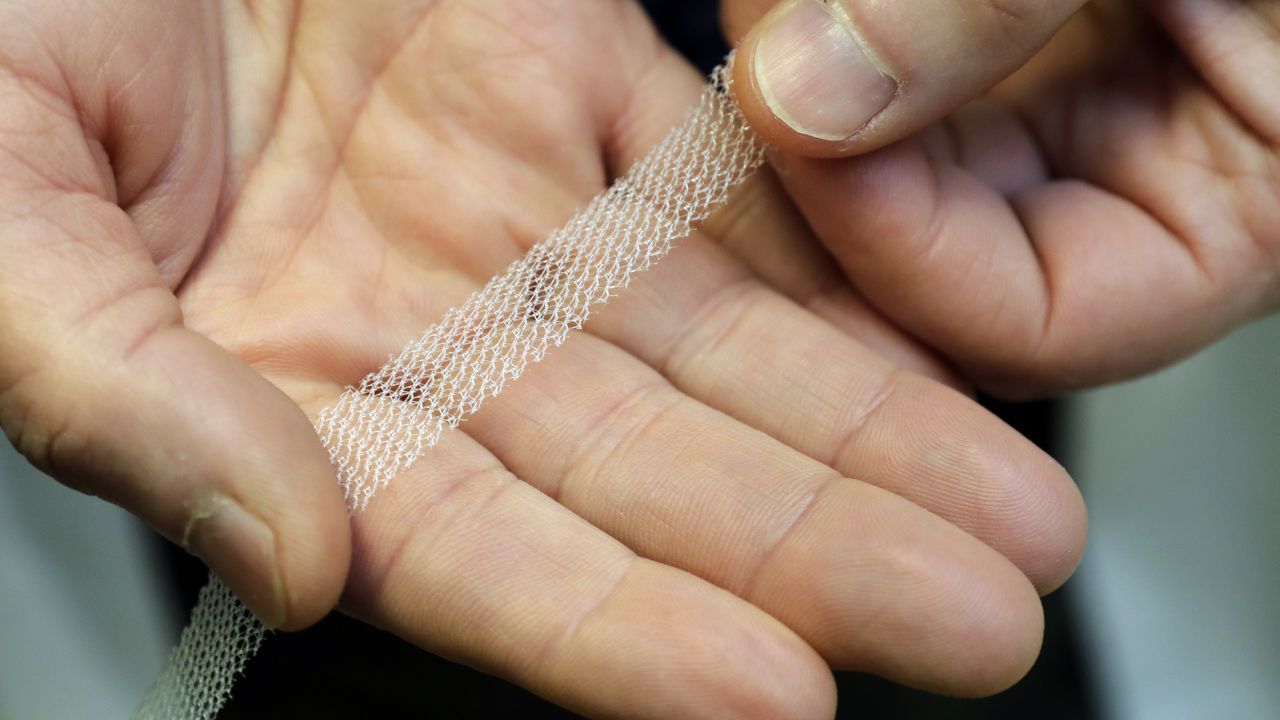 Transvaginal mesh has been used to treat pelvic floor disorders and incontinence in women.