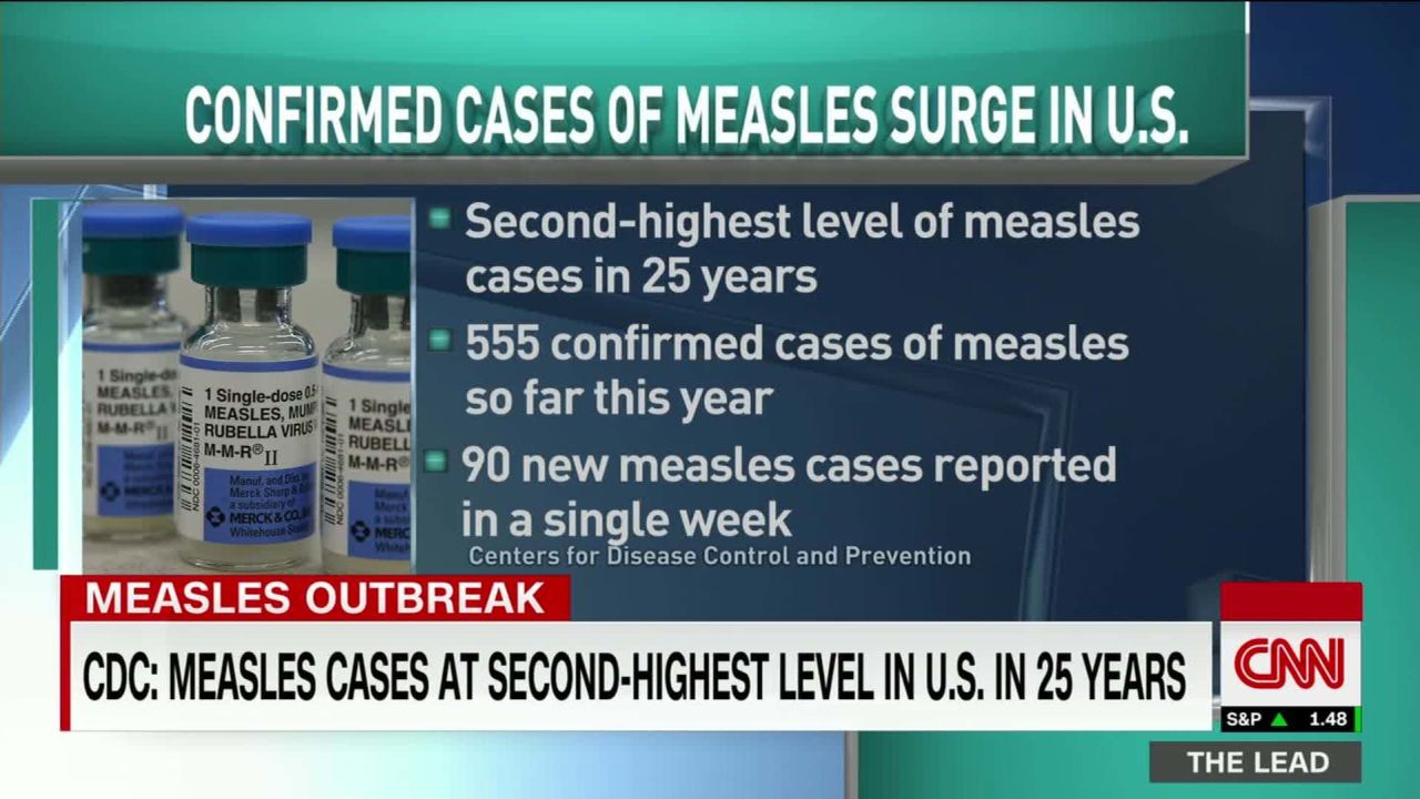 Lead Sanjay Gupta Measles Live Jake Tapper _00011313.jpg