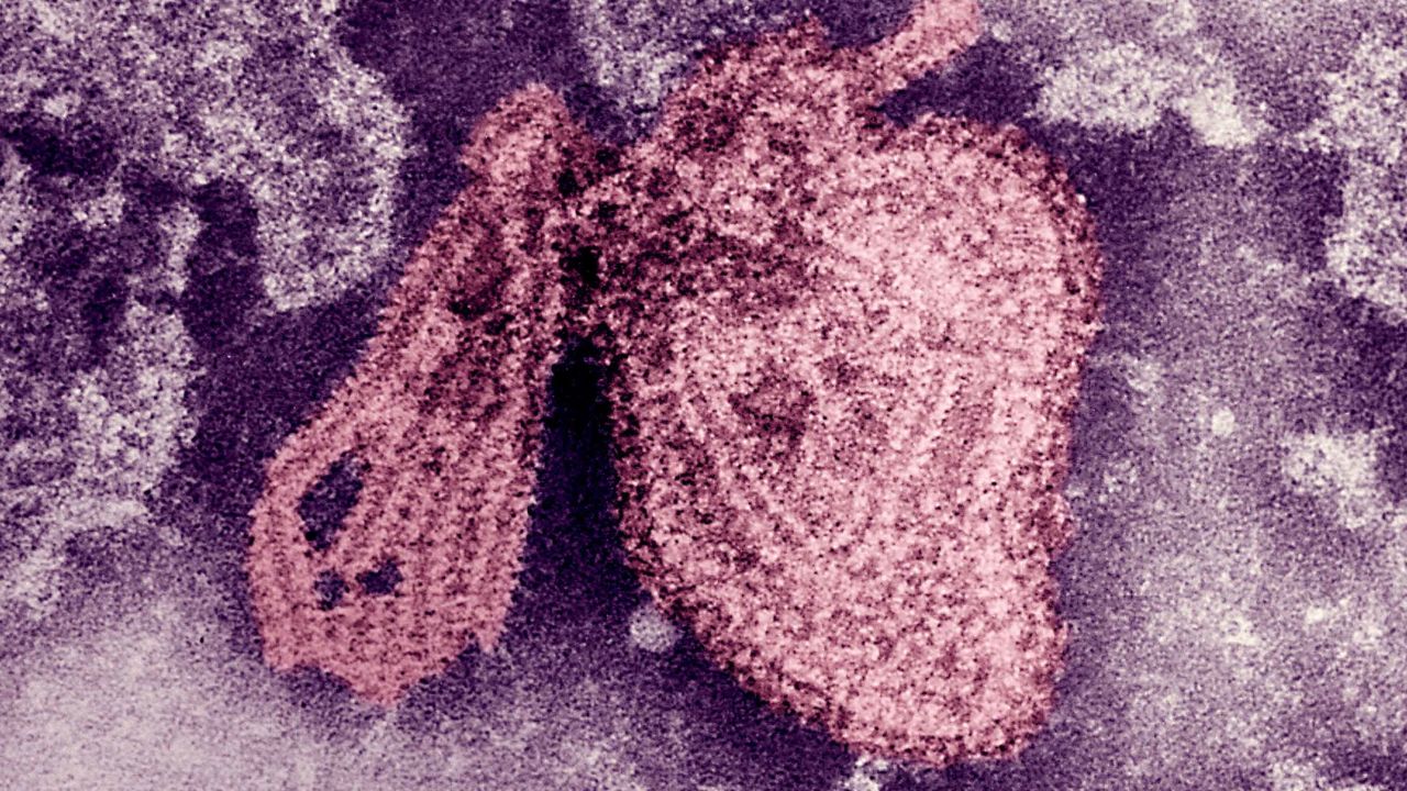 Indiana University mumps outbreak is linked mostly to a single