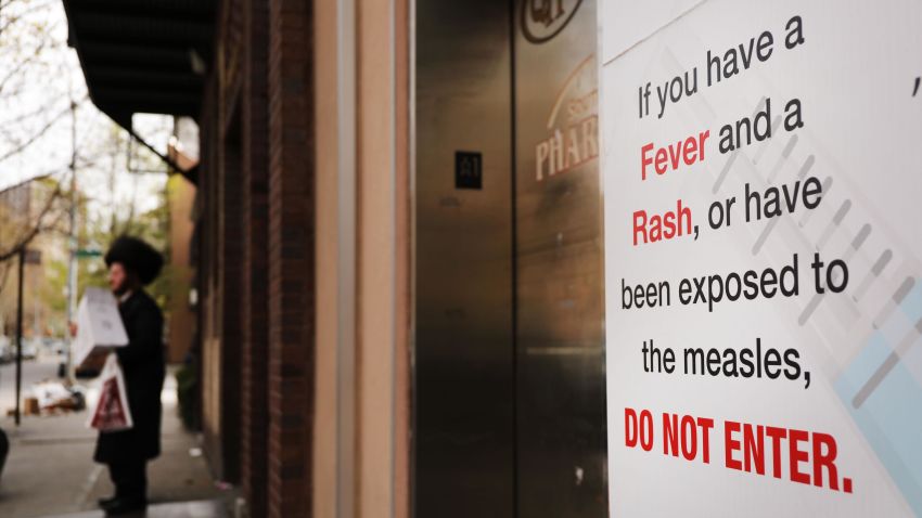 NEW YORK, NEW YORK - APRIL 19: A sign warns people of measles in the ultra-Orthodox Jewish community in Williamsburg on April 19, 2019 in New York City. As a measles epidemic continues to spread, New York City Mayor Bill de Blasio recently announced a state of emergency and mandated residents of the ultra-Orthodox Jewish community in Williamsburg at the center of the outbreak to get vaccinated for the viral disease. Those who choose not to will risk a $1,000 fine. (Photo by Spencer Platt/Getty Images)