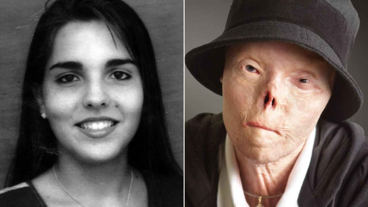 Jacqui Saburido, who became the face of an antidrunk driving campaign