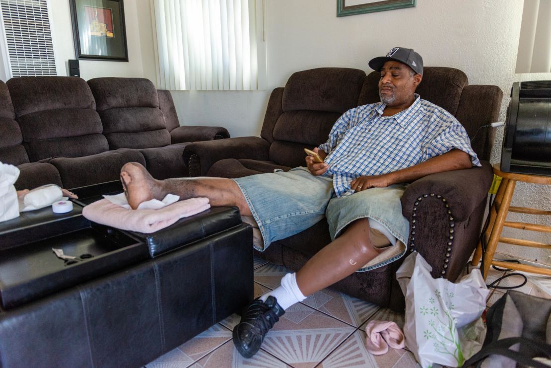 Jackson Moss had to stop working after his left leg was amputated below the knee about 10 years ago because of an infected wound.