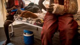 Two injured children sit inside a UNICEF tent at the regional hospital in Mopti.