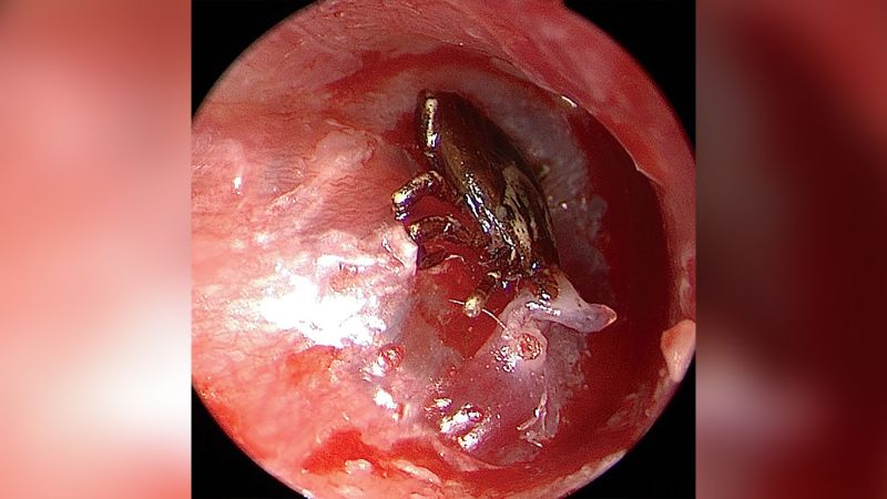 Tick in store dog ear canal