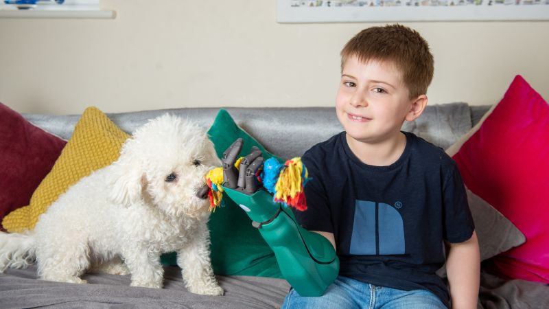 8-year-old makes history with 'superhero' bionic arm