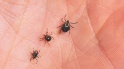 390650 07: A Close Up Of An Adult Female Deer Tick, Dog Tick, And A Lone Star Tick Are Shown June 15, 2001 On The Palm Of A Hand. Ticks Cause An Acute Inflammatory Disease Characterized By Skin Changes, Joint Inflammation, And Flu-Like Symptoms Called Lyme Disease.  (Photo By Getty Images)
