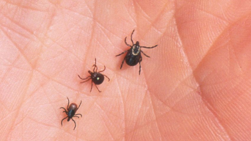 390650 07: A Close Up Of An Adult Female Deer Tick, Dog Tick, And A Lone Star Tick Are Shown June 15, 2001 On The Palm Of A Hand. Ticks Cause An Acute Inflammatory Disease Characterized By Skin Changes, Joint Inflammation, And Flu-Like Symptoms Called Lyme Disease.  (Photo By Getty Images)