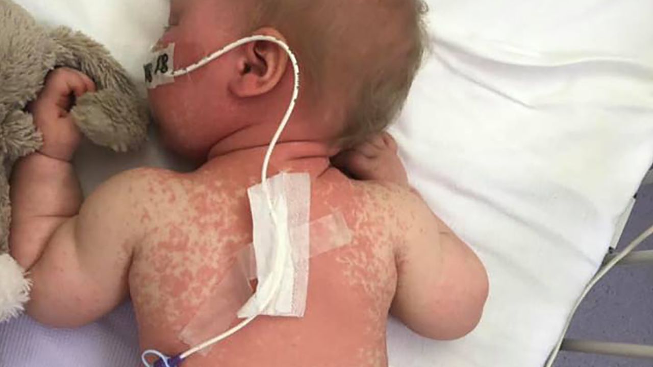 A doctor suggested that Alba's parents take photos of her while she was ill.