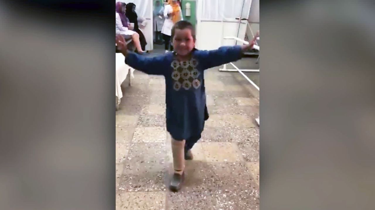 ahmad dancing boy goes viral afghanistan landmine prosthetic leg nr vpx_00001205