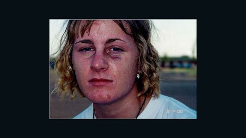 Harmony Allen one week after her rape on September 4, 2000, on Sheppard Air Force Base in Texas. She had previously worn makeup to hide her injuries; for this photo, she was asked to wash her face.