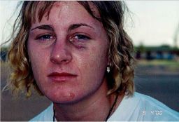 Harmony Allen one week after her rape on September 4, 2000, on Sheppard Air Force Base in Texas. She had previously worn makeup to hide her injuries; for this photo, she was asked to wash her face.