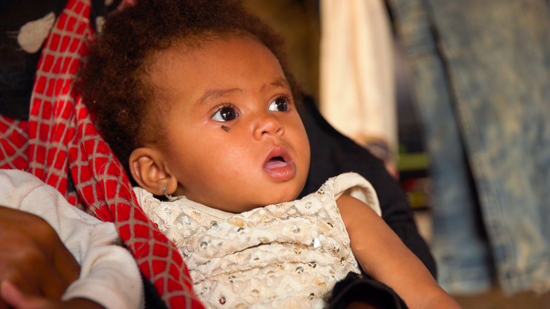 Issham is two years old, but has yet to take her first steps. Her family has received no food aid in weeks.