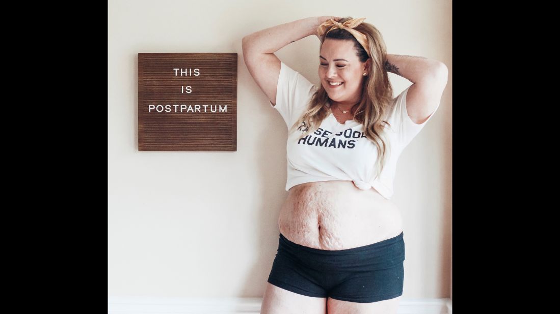A postpartum photo of 4 moms got thousands of negative comments