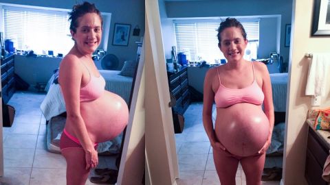 Desiree Fortin's 105-pound body had to stretch as her three babies grew to 5-pounds each.