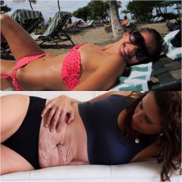 Fortin shares her body before and after carrying and giving birth to triplets