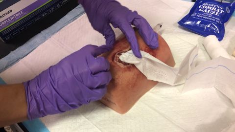 An attendee of the Stop the Bleed class uses a dummy to practice packing a wound with gauze. 
