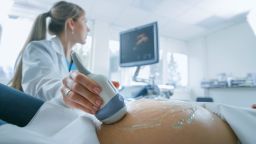 In the Hospital, Close-up Shot of the Doctor does Ultrasound / Sonogram Procedure to a Pregnant Woman. Obstetrician Moving Transducer on the Belly of the Future Mother.; Shutterstock ID 1130966555; Job: -