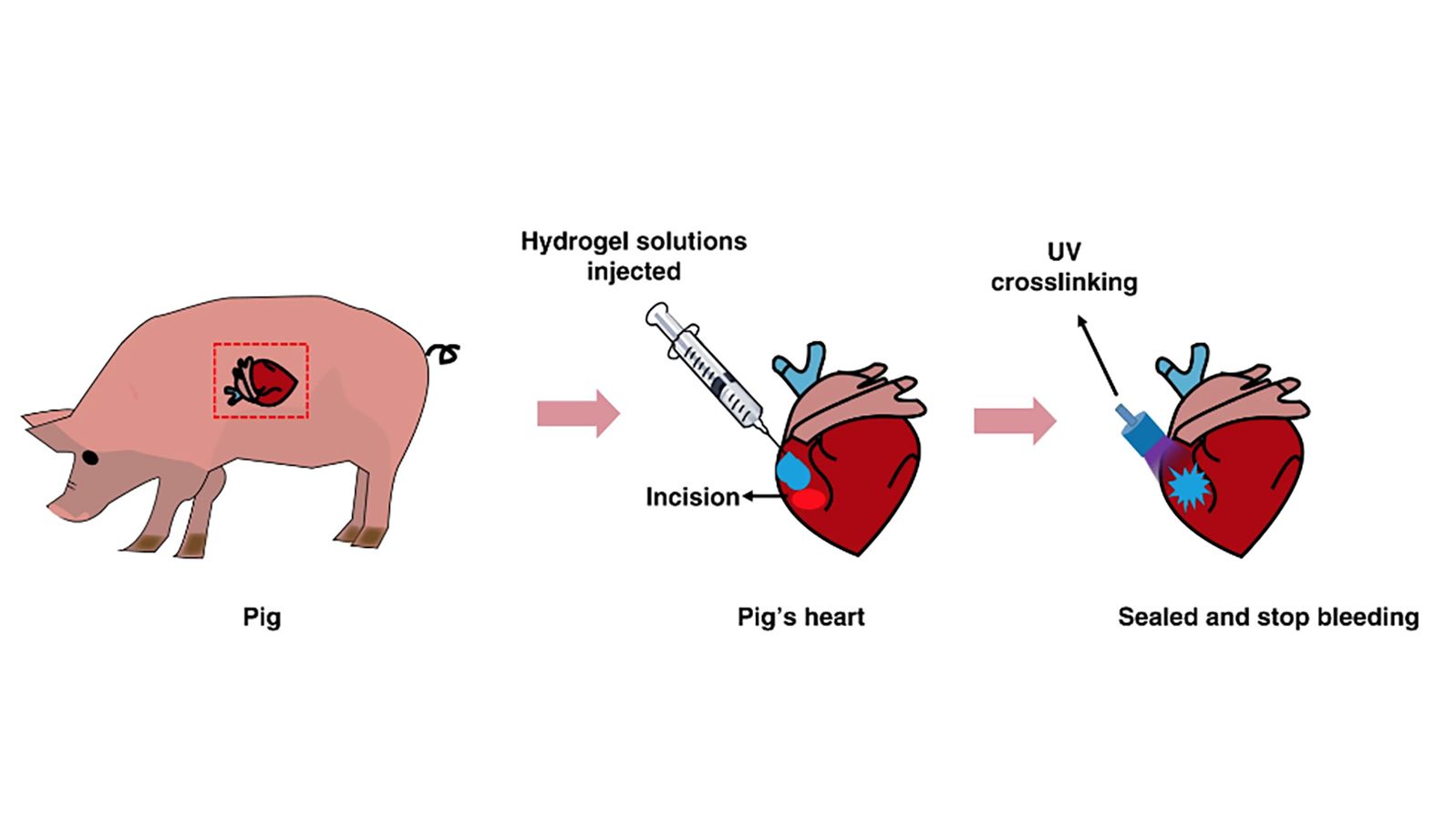 A diagram of how researchers used adhesive hemostatic hydrogel for the repair of arterial and heart bleeds in pigs.