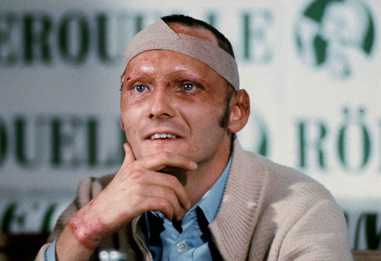 Lauda, with scarred face, bandaged head and burn wounds during a news conference in Salzburg, Austria on September 8, 1976.
