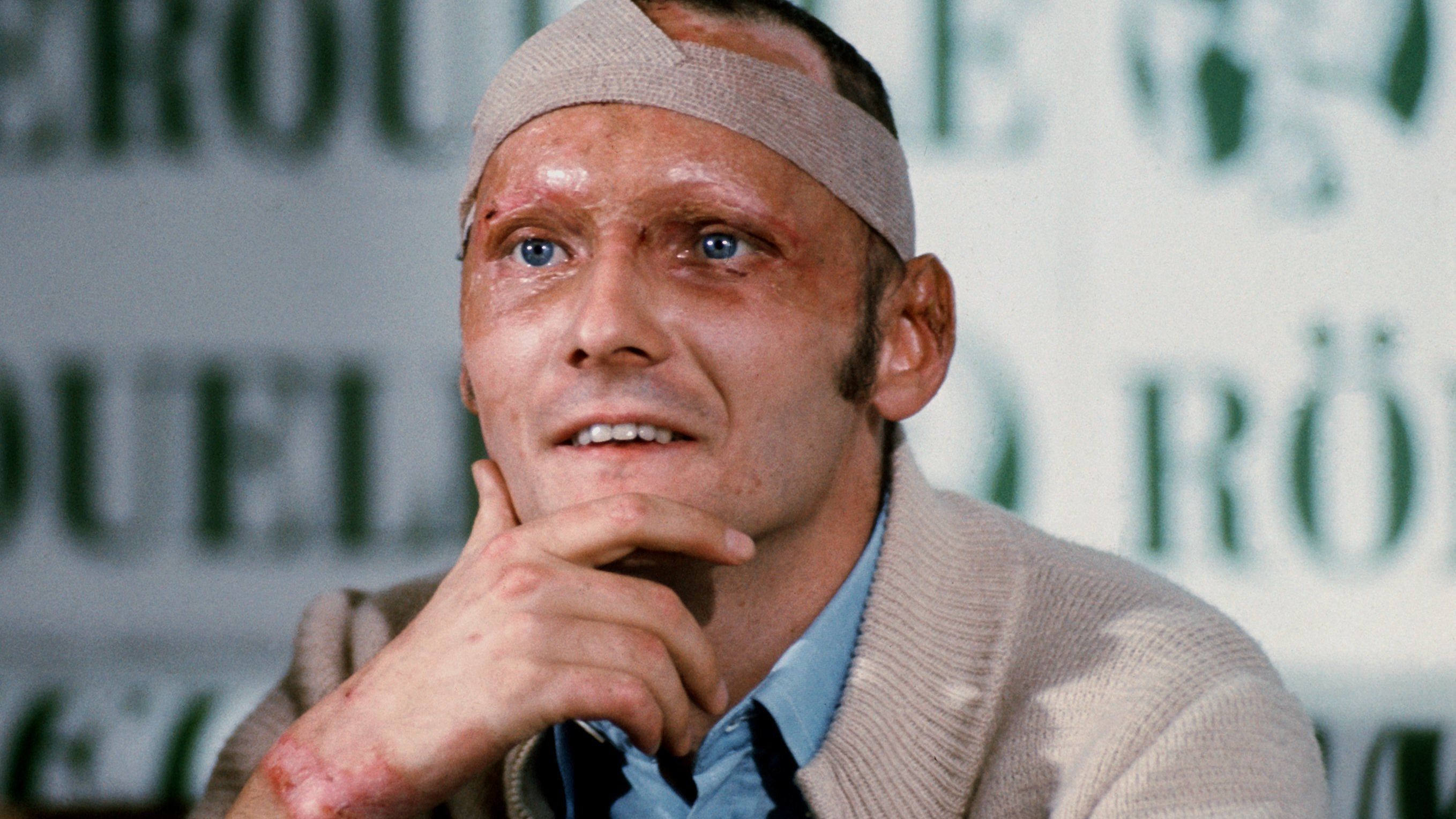 Lauda, with scarred face, bandaged head and burn wounds during a news conference in Salzburg, Austria on September 8, 1976.