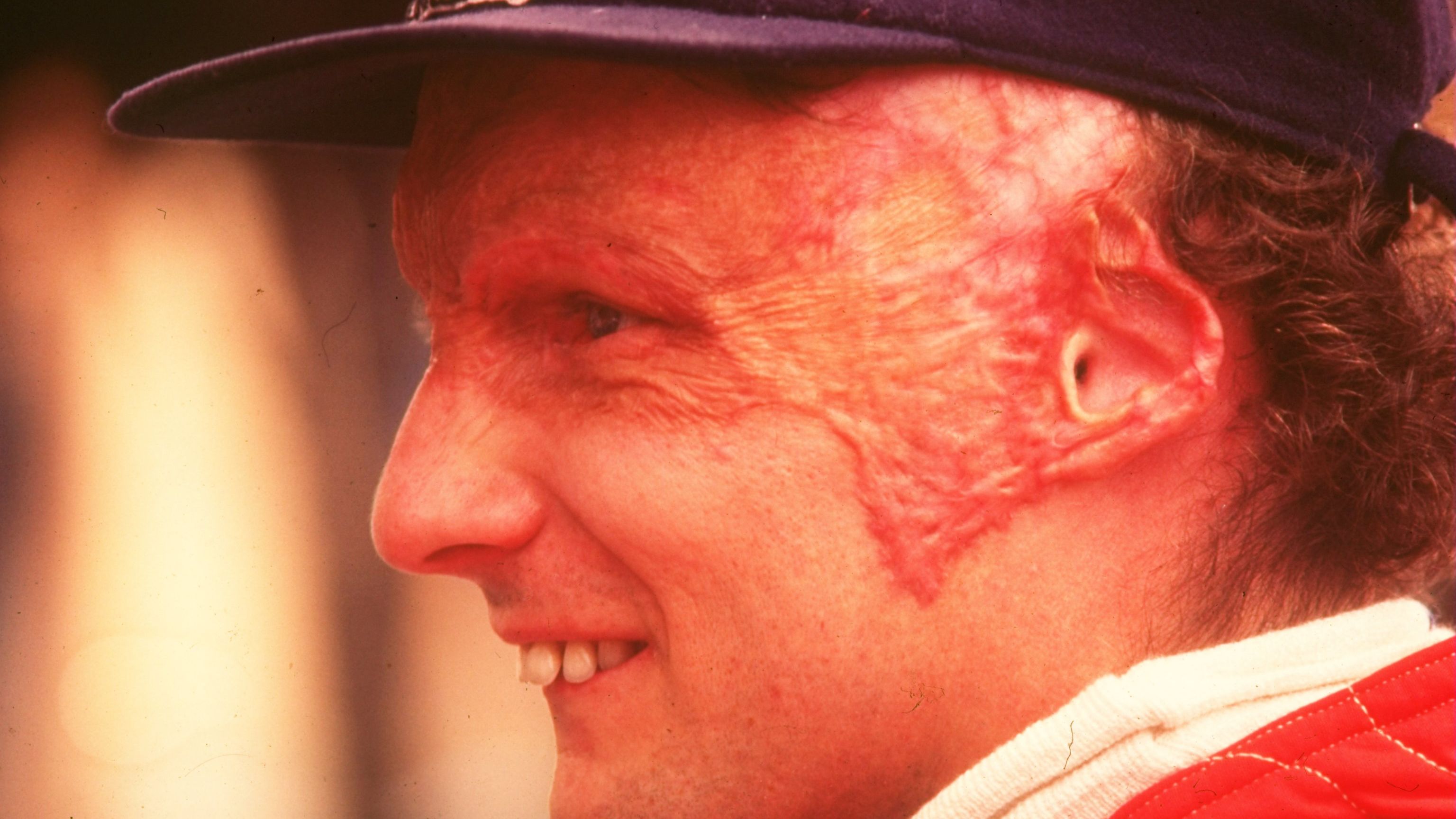 Lauda is pictured before finishing fourth at the Italian Grand Prix at the Monza circuit in Italy.