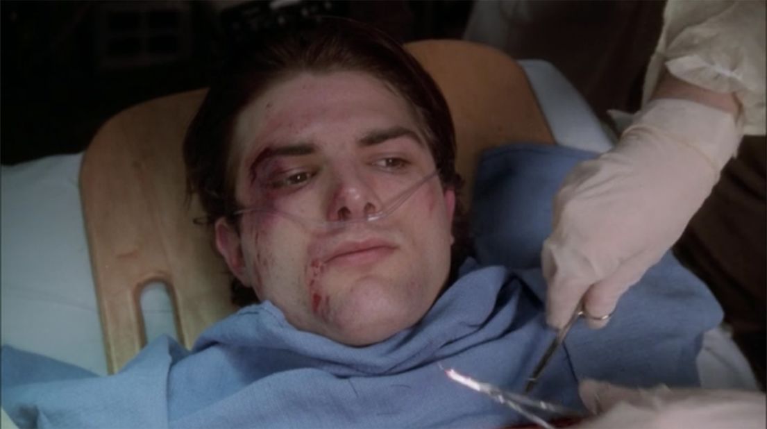 The "Parks and Recretion" actor comes into the ER in a Season 1 episode ("Full Moon, Saturday Night") after being hit by a car.